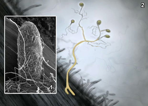 Photomontage of an artificially-coloured optical microscopy photo of a rootlet and root hairs of a red pine (Pinus resinosa), and of a mycorrhizal fungus (Wilcoxina mikolae), in yellow, and of an electron microscopy photo of a root hair